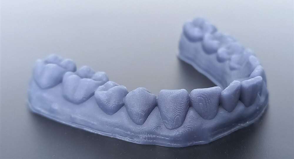 Ventajas de la Impresión de férulas oclusales en 3D